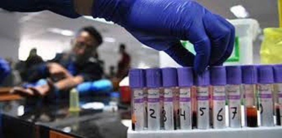 Khoảng 700.000 người Indonesia có nguy cơ mắc Covid-19 - Anh 1