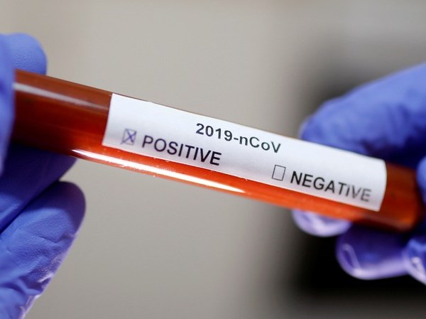 Việt Nam nghiên cứu thành công sinh phẩm test Covid-19 chính xác 90% - Anh 1