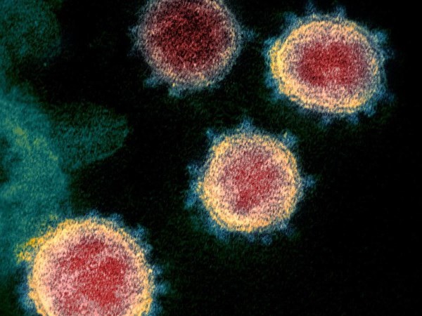 WHO cảnh báo virus Sars CoV-2 có thể không bao giờ biến mất - Anh 1