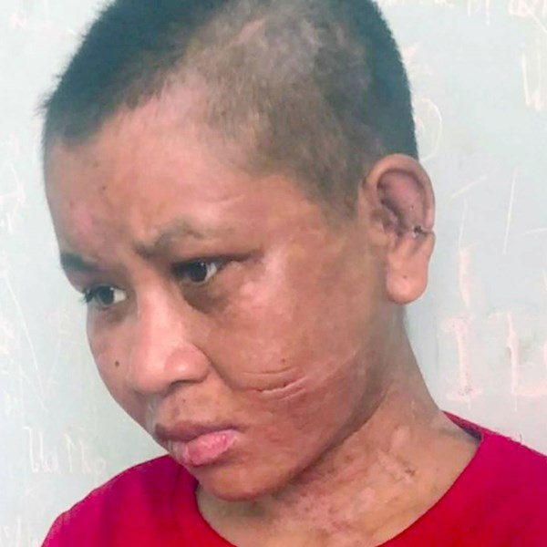 Điều tra vụ cô gái bị hành hạ dã man - Anh 1