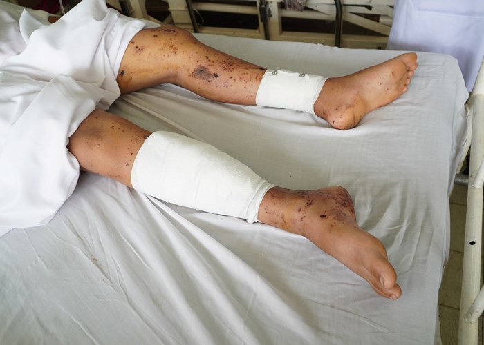 Tự học chế tạo pháo nổ trên mạng, 2 nam sinh thương vong - Anh 2