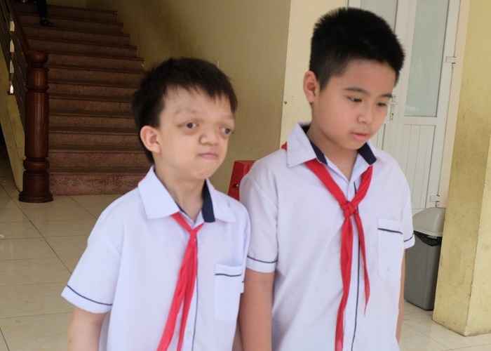Cảm phục nghị lực vươn lên của cậu học trò lớp 5 nghe giảng bằng xương - Anh 1