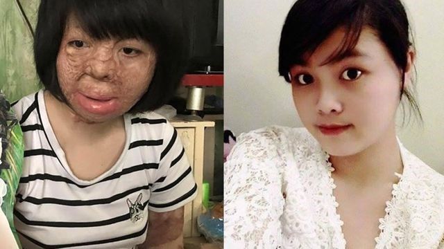 Người vợ xinh đẹp bị chồng đốt ngày mùng 2 Tết giờ ra sao? - Anh 1