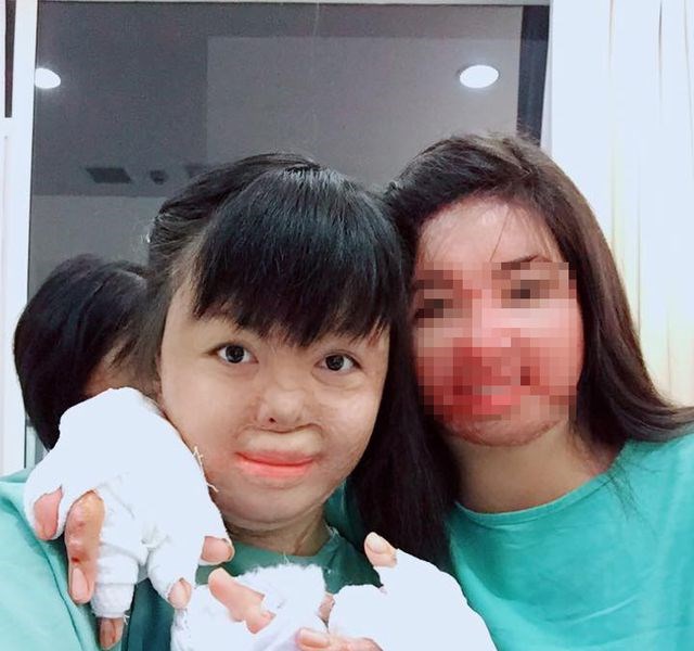 Người vợ xinh đẹp bị chồng đốt ngày mùng 2 Tết giờ ra sao? - Anh 3