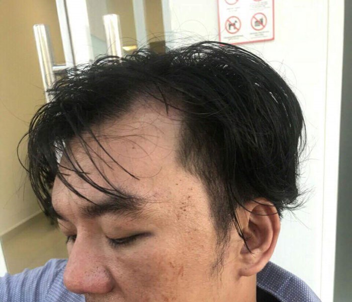 Đà Nẵng: Du khách bị đánh vì đi ăn quên...mang tiền? - Anh 2