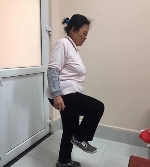 Hậu quả của tự bó chân và uống thuốc giảm đau - Anh 1