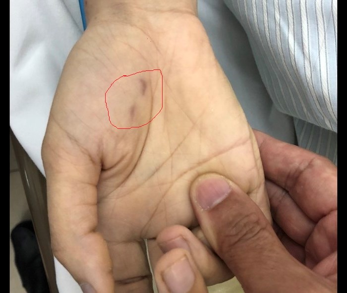 Một bác sĩ thú y tử vong vì bị chó dại cắn - Anh 1