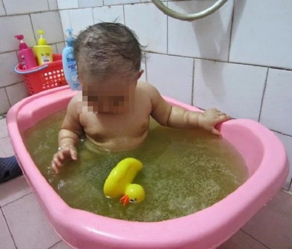 Sử dụng lá tắm khiến bệnh của trẻ trở nên nặng hơn - Anh 2