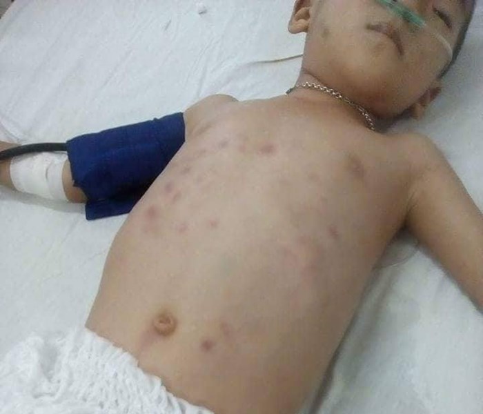 Nỗi lòng của người mẹ​ có con bị “người tình” bạo hành nguy kịch - Anh 1