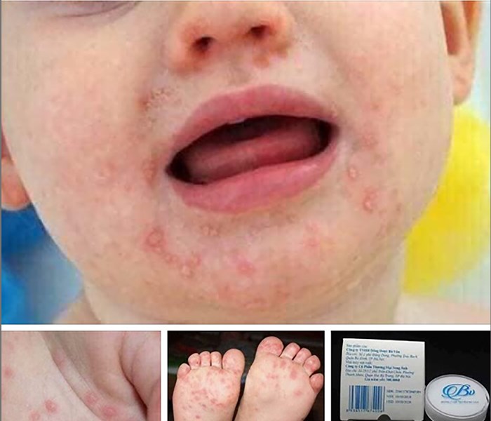 Tràn lan quảng cáo thuốc gia truyền trên MXH: Hiểm nguy rình rập - Anh 1