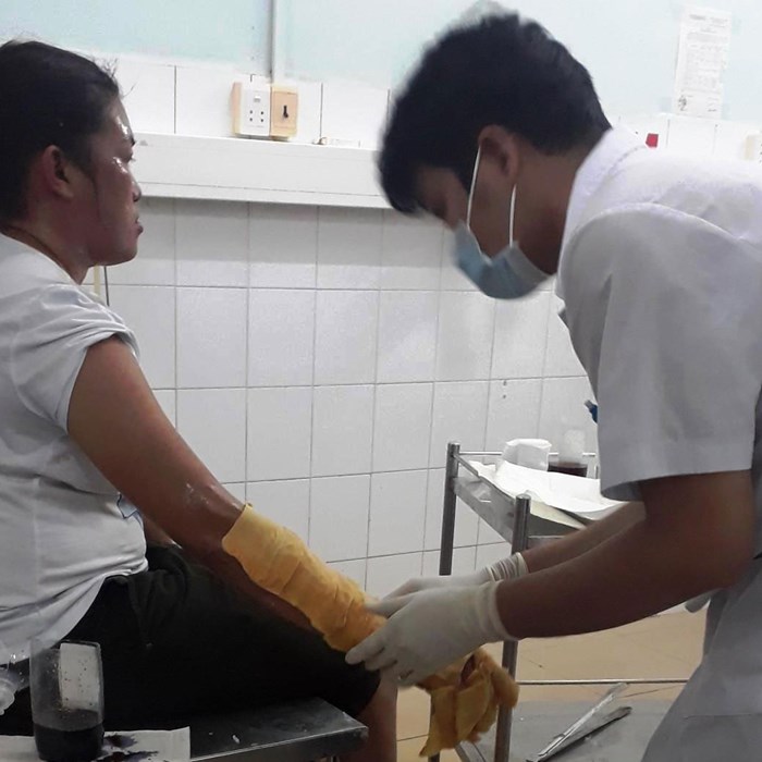 Phú Quốc: Nổ bình gas mini ở chợ đêm, nhiều khách du lịch bị bỏng - Anh 1