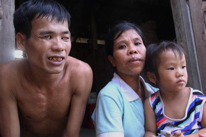 Cảm động chuyện tình “rổ rá” giữa cô nàng “chân voi” và anh chàng mù - Anh 4