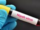 Ấn Độ tuyên bố đã kiểm soát được ổ dịch virus Nipah