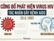 Công bố phát hiện virus HIV gây bệnh AIDS